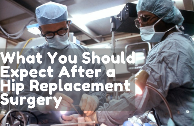 What You Should Expect After A Hip Replacement Surgery